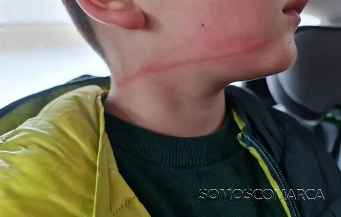 somoscomarca_202600511_obarco_canchatenis_ni&ntilde;oheridas3452