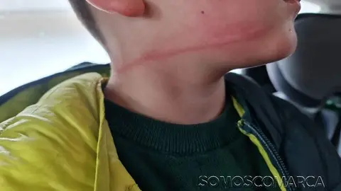Una madre denuncia el mal estado de una cancha de tenis de O Barco tras un incidente con su hijo